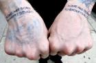 Vamoose Tattoo Removal
