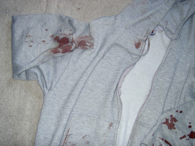 Michael O' Reilly's sweatshirt was bloodied after two men attacked him for $40 in Isham Park on June 6, 2012. 