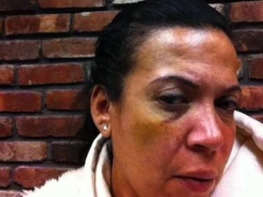 The EMT said she felt "defeated" by news that the felony charges against him are unlikely to stick.